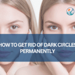 How To Get Rid of Dark Circles Permanently