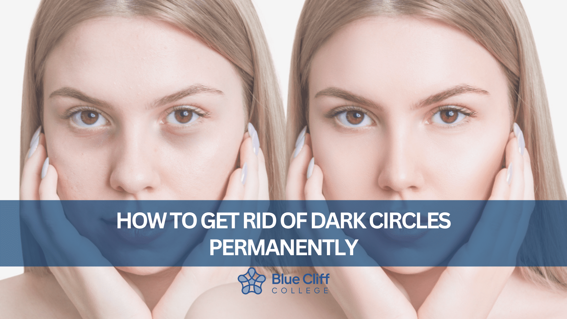 Read more about the article How To Get Rid of Dark Circles Permanently